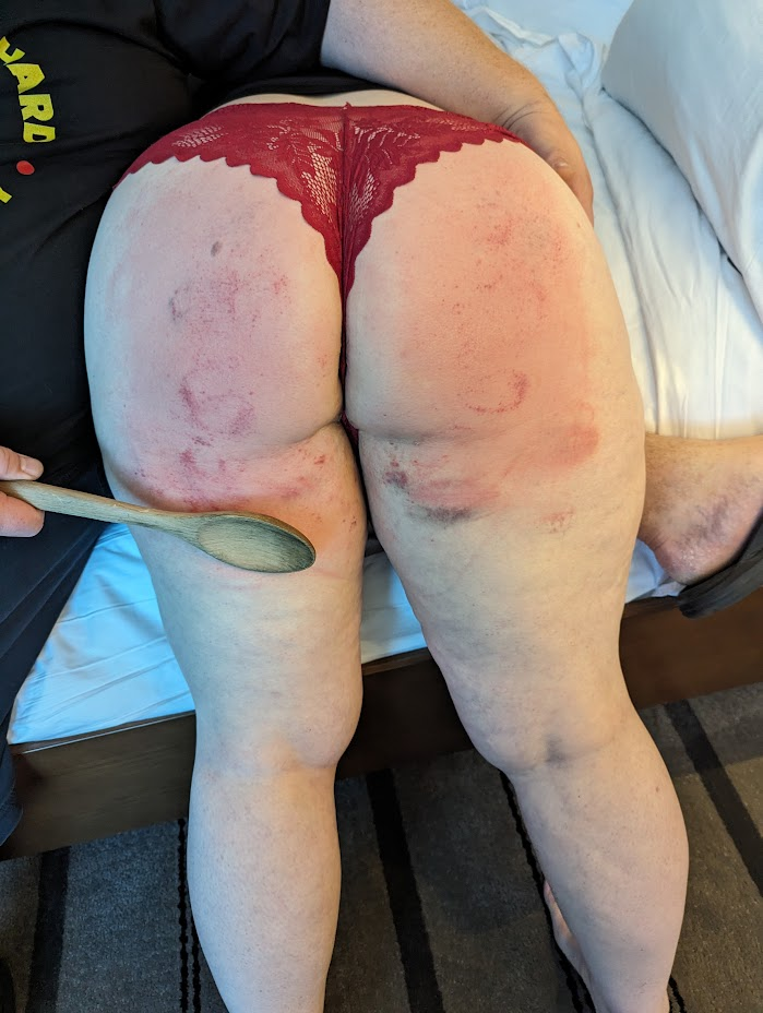 Partner 1's red and bruised bottom, in red panties, with a wooden spoon, as she is over the lap of a spanker who isn't me.